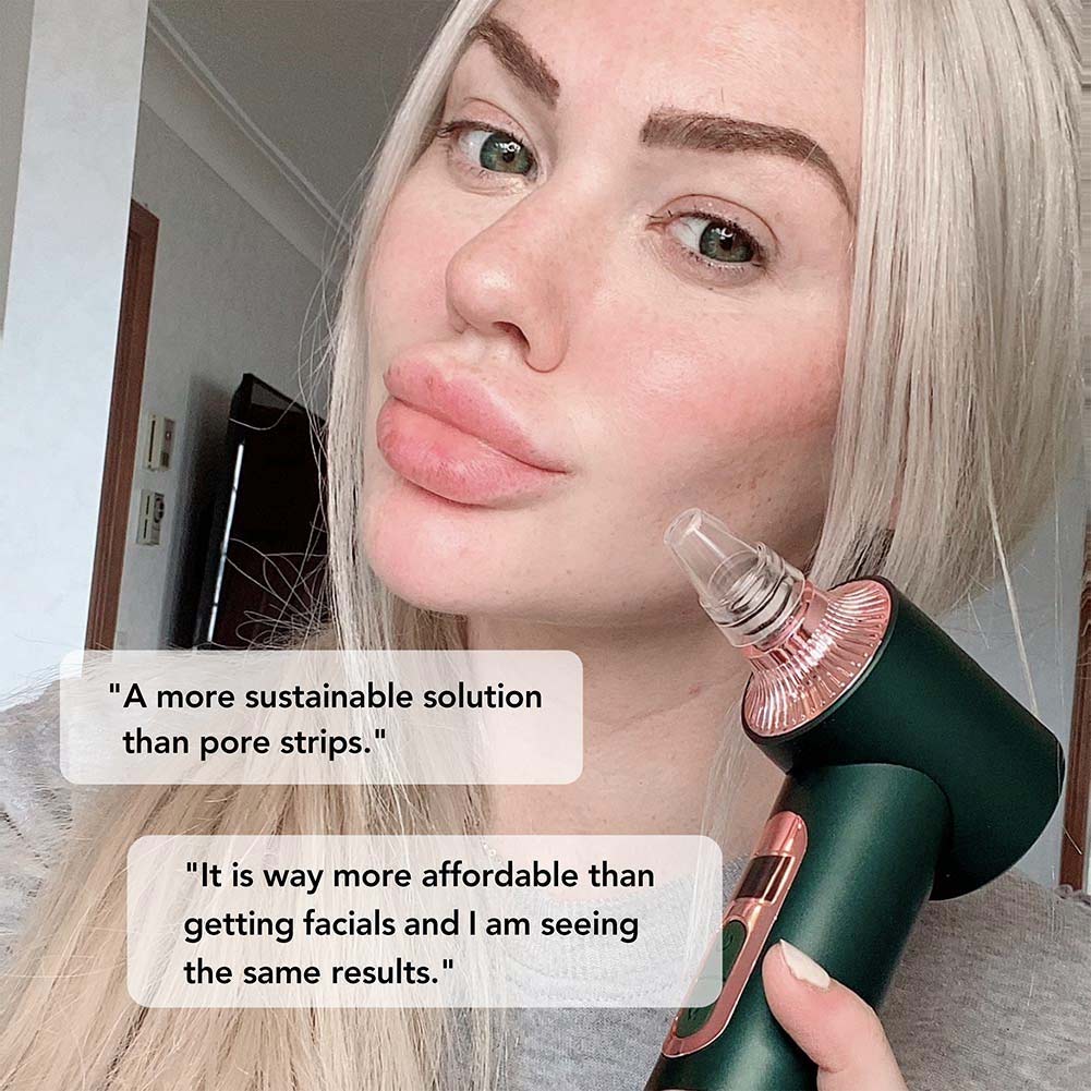 Clara 4-in-1 Microdermabrasion & Pore Vacuum - Spa Glow Ritual | Louvrs