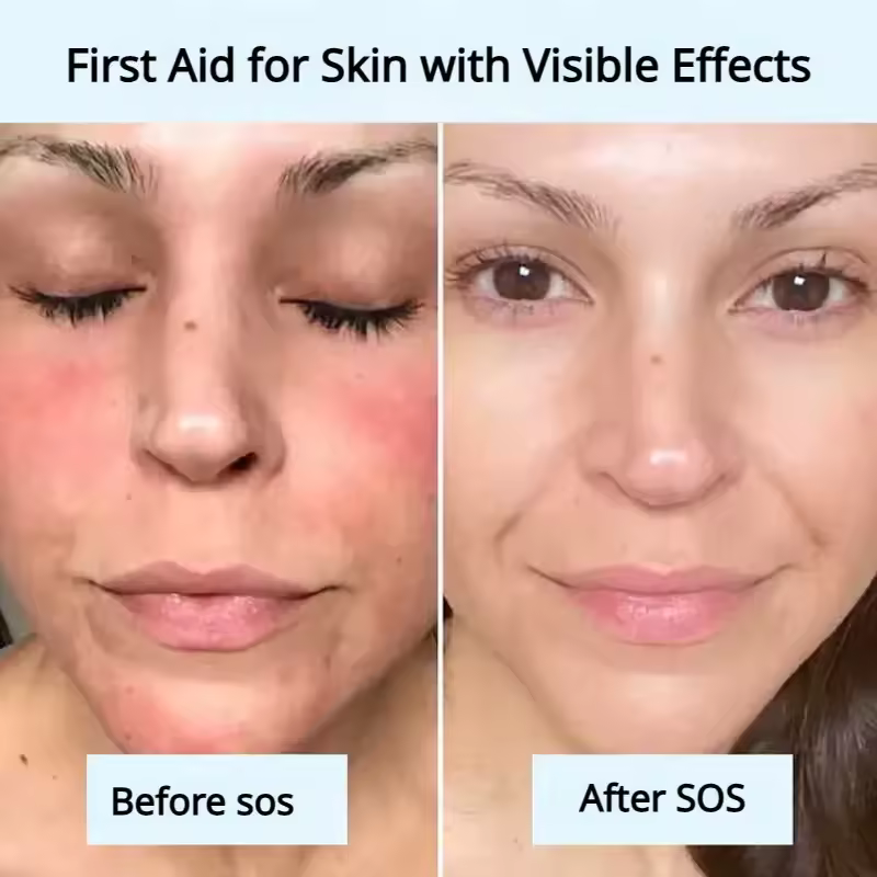Before and after results showing reduced facial redness and improved skin hydration using BioCollagen sheet mask.