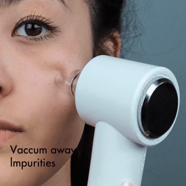 Clara 4-in-1 Microdermabrasion & Pore Vacuum - Spa Glow Ritual | Louvrs