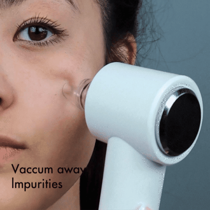 Clara 4-in-1 Microdermabrasion & Pore Vacuum - Spa Glow Ritual | Louvrs