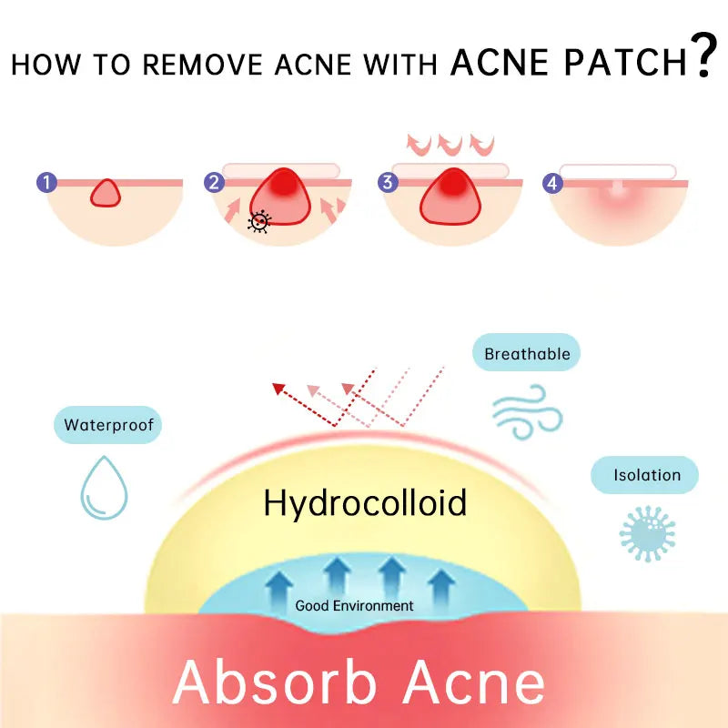 AUQUEST Invisible Zit Patch - Buy 1 Get 2 for Clear, Confident Skin